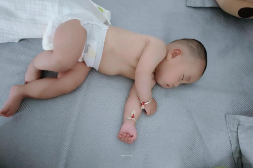 溧阳六个月宝宝眼睛散光